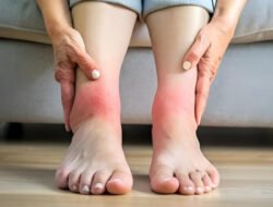 Daftar Makanan Pemicu Asam Urat yang Wajib Penderita Jauhi