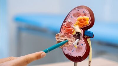 Ilustrasi - Kenali tanda bahaya gagal ginjal yang mengincar kelompok usia produktif. Ketahui lima gejala awalnya untuk mencegah kerusakan ginjal semakin parah. (Dok. Ist)