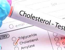 Turunkan Kolesterol Tanpa Obat Melalui Tujuh Langkah Alami