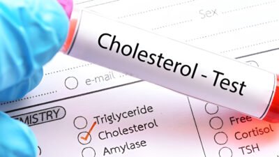 Ilustrasi - Masyarakat bisa menerapkan tujuh langkah alami untuk menurunkan kolesterol tinggi di dalam tubuh tanpa harus bergantung pada konsumsi obat-obatan. (Dok. Ist)
