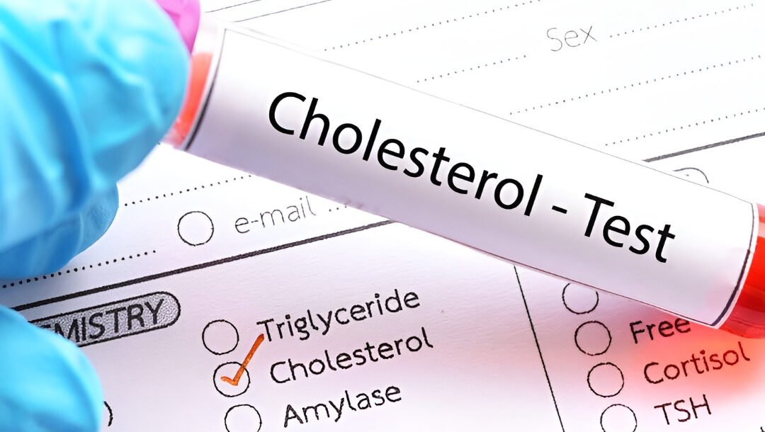 Ilustrasi - Masyarakat bisa menerapkan tujuh langkah alami untuk menurunkan kolesterol tinggi di dalam tubuh tanpa harus bergantung pada konsumsi obat-obatan. (Dok. Ist)
