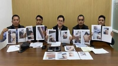 Sejumlah cetakan foto yang memperlihatkan kondisi luka pada tubuh para siswa akibat dugaan tindak kekerasan di lingkungan asrama.