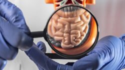 Ilustrasi - Masyarakat wajib mengenali ciri kanker usus besar sejak dini. Gejala penyakit mematikan ini tidak hanya BAB berdarah, tetapi juga diare dan benjolan perut. (Dok. Ist)