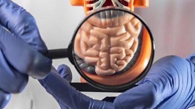 Ilustrasi - Masyarakat wajib mengenali ciri kanker usus besar sejak dini. Gejala penyakit mematikan ini tidak hanya BAB berdarah, tetapi juga diare dan benjolan perut. (Dok. Ist)