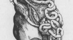 "Usus yang tidak sehat berdampak pada seluruh organ tubuh. Ketahui 5 tanda usus kamu kotor, mulai dari sembelit hingga masalah bau mulut dan jerawat."