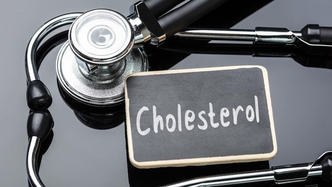 "Kolesterol tinggi kini rentan menyerang usia 20-an. Ketahui 6 kebiasaan buruk anak muda pemicu kolesterol, mulai dari kurang gerak hingga hobi minuman manis."