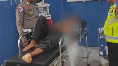 Pengendara motor berusia 17 tahun menderita luka parah dan patah tulang
