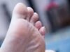 Cara Mengatasi dan Mencegah Kapalan di Kaki Akibat Salah Pilih Sepatu