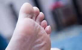 Gesekan kulit akibat sepatu sempit memicu penebalan kulit. Ketahui penyebab serta cara mencegah kapalan di kaki agar terhindar dari nyeri dan infeksi.
