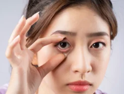 Kenali Karakter Wajahmu, Ini Jenis-Jenis Bentuk Mata yang Jarang Disadari