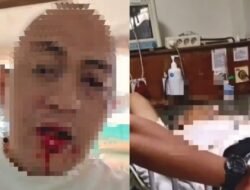 Nama Oknum Polisi Terseret di Kasus Pengeroyokan Khatulistiwa Plaza, Kuasa Hukum: Tangkap Pelaku, Jangan Tebang Pilih!