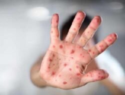 Belum Terima Vaksin, 38 Anak di Bangladesh Meninggal Dunia Akibat Wabah Campak